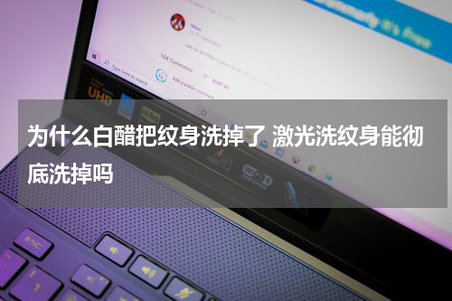 为什么白醋把纹身洗掉了 激光洗纹身能彻底洗掉吗